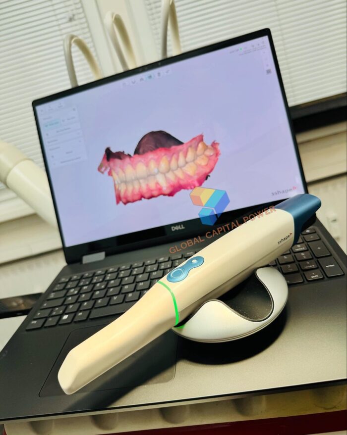 3Shape TRIOS 6 Wireless Intraoral Scanner - Global Capital Power