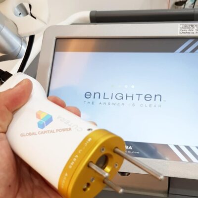 Cutera Enlighten III Laser System
