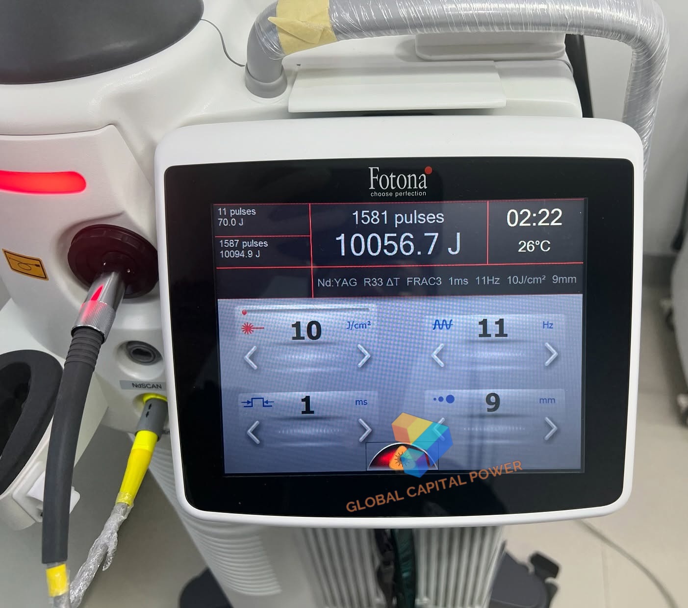 Fotona SP Dynamis Pro Laser System