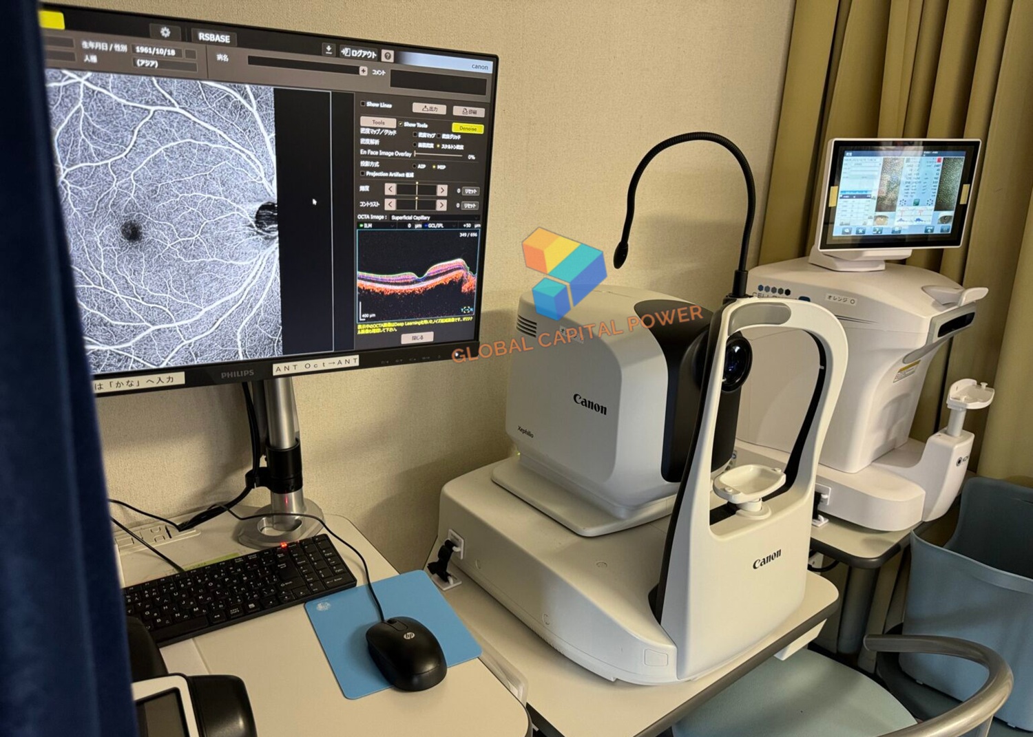 Canon Xephilio OCT-A1