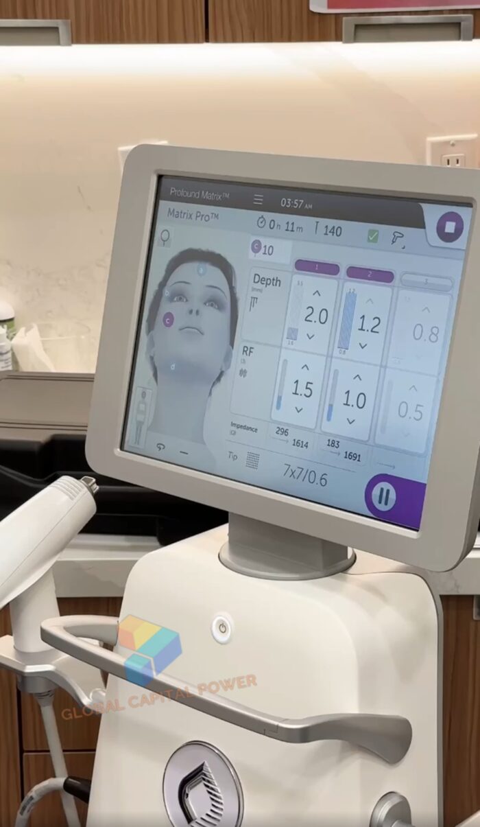Matrix Pro Rfmn Candela Matrix Pro RF Microneedling Device - Global Capital Power
